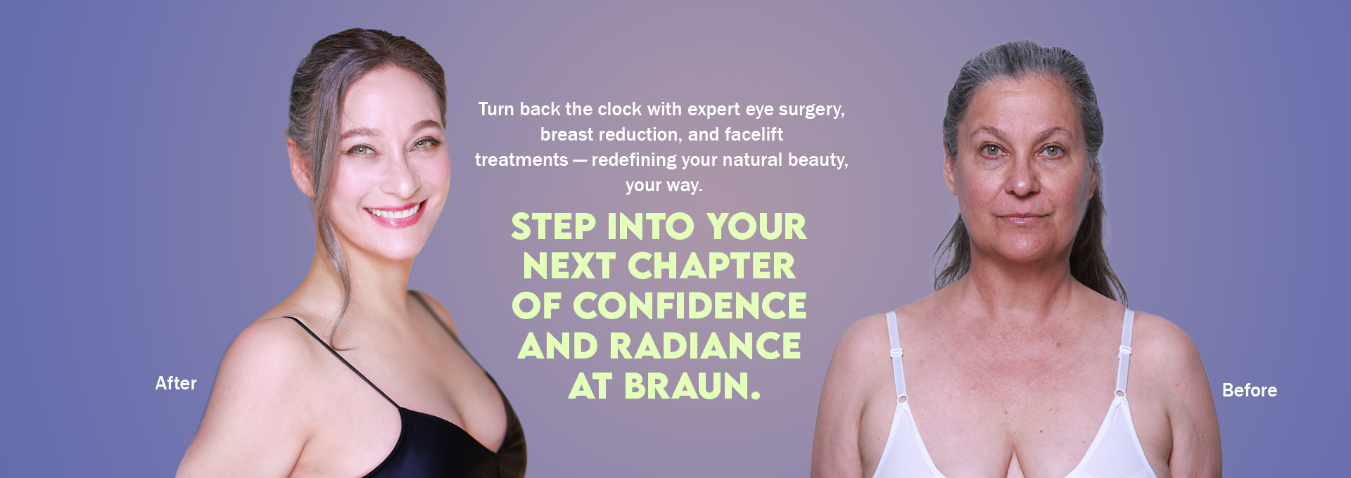 /data/apms/background/BRAUN before and after facelift and eye surgery results showing natural facial rejuvenation.jpg